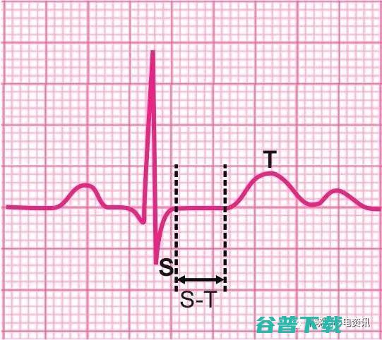 ST规范版 4万公里爱护名目多少钱 福特福克斯 手动 2013款 出口 (st规定)