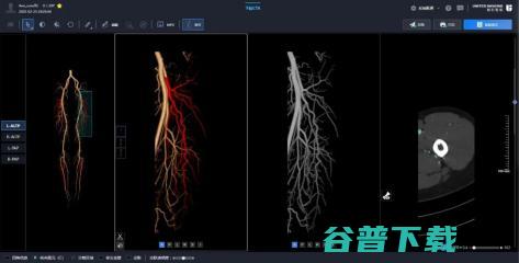 香港大学牙医学院携手联影智能，成功“全球首例”由混合大模型驱动的口腔颌面整复手术