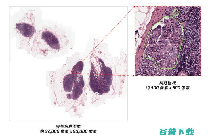 Lab 绝悟 阅片效率提升400% 首次将强化学习引入病理全片扫描 腾讯AI (绝悟 20)