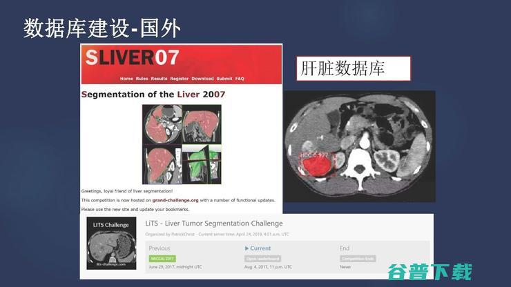 吉大一院放射科主任张惠茅：中外医学影像 AI 的进展对比