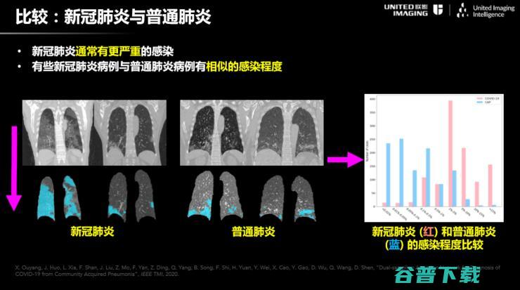 联影智能联席CEO沈定刚：如何将AI应用到新冠肺炎诊断全流程？ | CCF-GAIR 2020