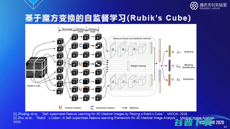 腾讯天衍实验室郑冶枫：医学影像AI为什么需要小样本学习和域自适应技术？ | CCF-G 2020