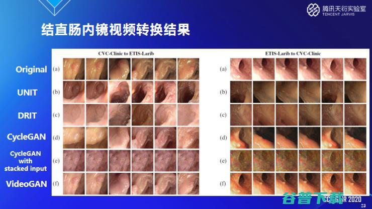 腾讯天衍实验室郑冶枫：医学影像AI为什么需要小样本学习和域自适应技术？ | CCF-G 2020