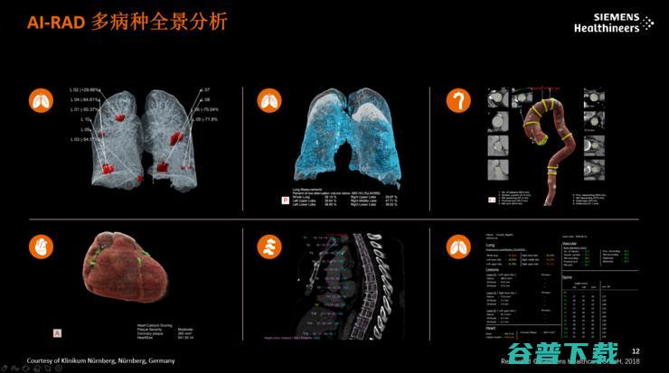 西门子医疗陈黎峰：医疗决策精准化的「痛点」与「突破」| CCF-GAIR 2020