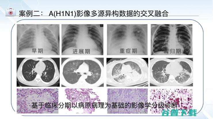 北京佑安放射科主任李宏军：我为什么力挺AI与影像基因组学的结合前景？｜CMAI 2022