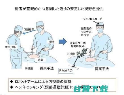 关于那些被热议的手术机器人，我们都知道些什么