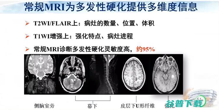 医科大学宣武医院副院长卢洁教授：AI在脑脱髓鞘病MRI中，有哪些应用？｜CMAI 2022