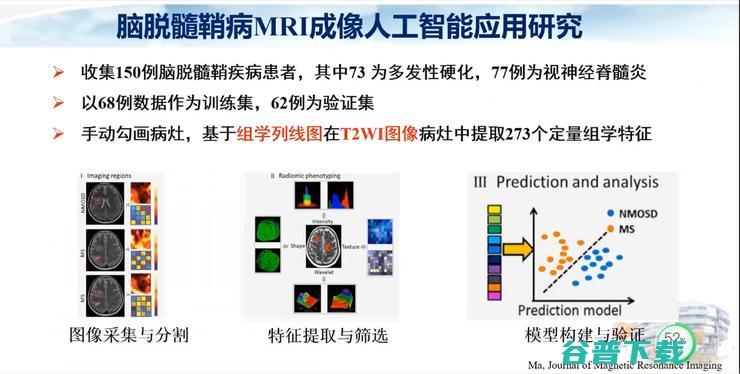 医科大学宣武医院副院长卢洁教授：AI在脑脱髓鞘病MRI中，有哪些应用？｜CMAI 2022