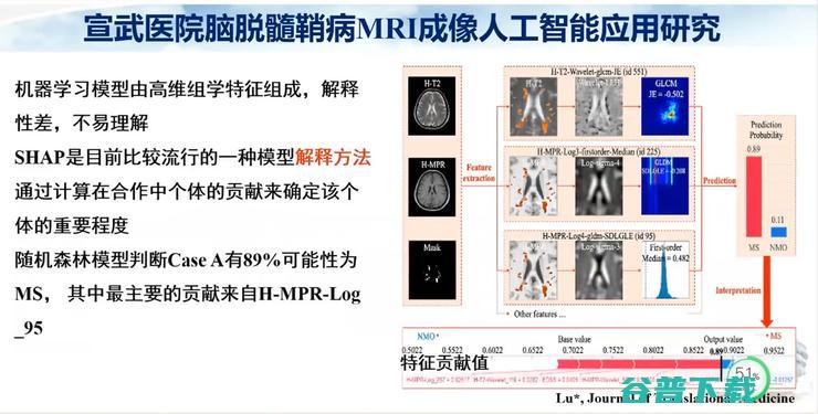 医科大学宣武医院副院长卢洁教授：AI在脑脱髓鞘病MRI中，有哪些应用？｜CMAI 2022