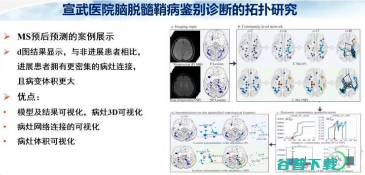 医科大学宣武医院副院长卢洁教授：AI在脑脱髓鞘病MRI中，有哪些应用？｜CMAI 2022