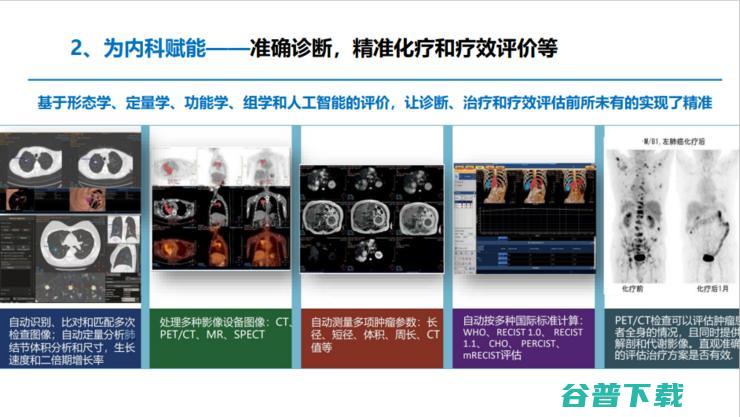 中放主委刘士远教授：影像学发展的五大趋势，如何助力「健康中国」？