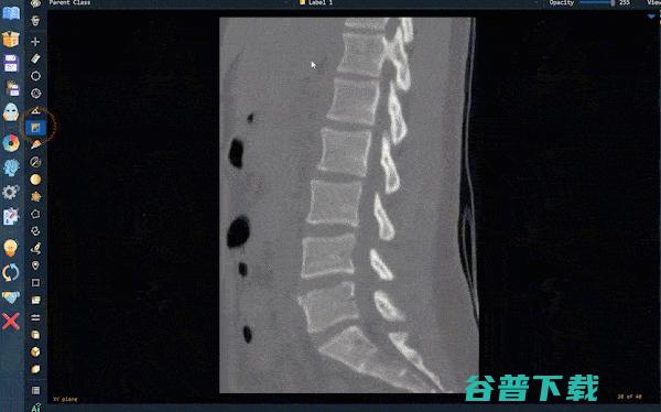 深圳大学MUSIC实验室推出一款软件神器，大大提升影像AI标注的质量与一致性