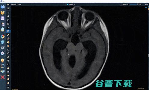 深圳大学MUSIC实验室推出一款软件神器，大大提升影像AI标注的质量与一致性