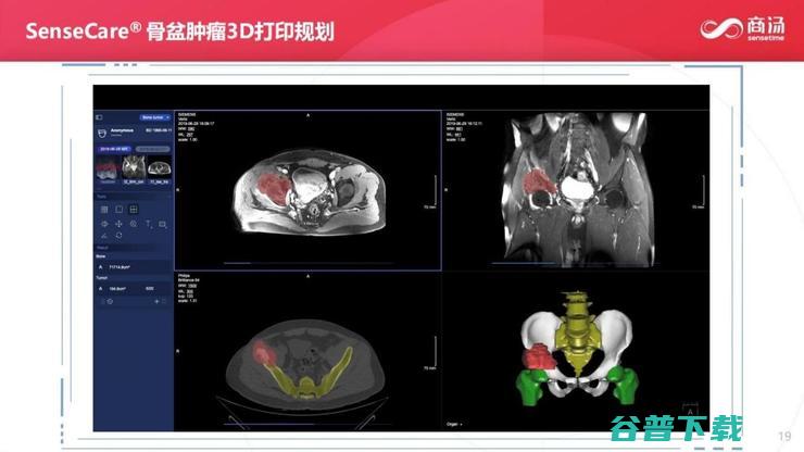 商汤科技副总裁张少霆：AI 赋能临床医疗的心得 | CCF-GAIR 2020