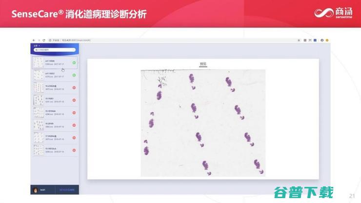 商汤科技副总裁张少霆：AI 赋能临床医疗的心得 | CCF-GAIR 2020