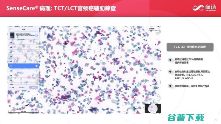 商汤科技副总裁张少霆：AI 赋能临床医疗的心得 | CCF-GAIR 2020