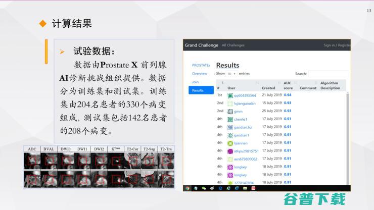 复旦宋志坚教授：深度学习在mpMRI图像处理、医疗数据增强方面的工作心得 | ISICDM 