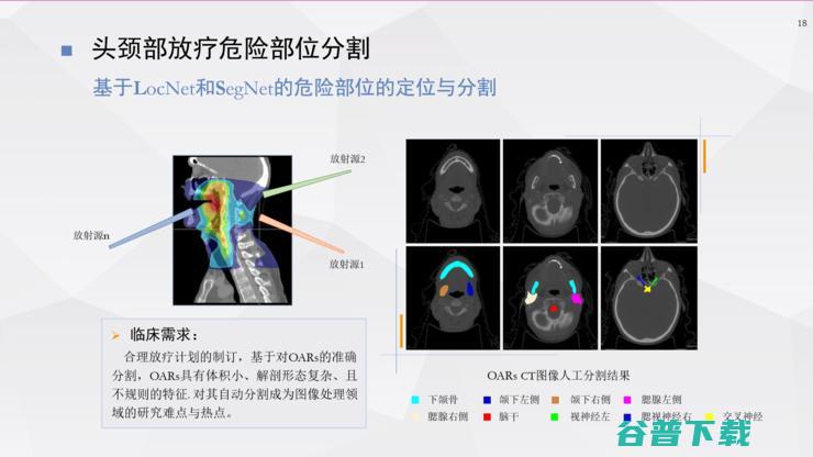 复旦宋志坚教授：深度学习在mpMRI图像处理、医疗数据增强方面的工作心得 | ISICDM 