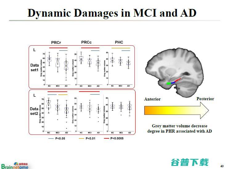 万字长文 | 中科院蒋田仔教授：脑网络组图谱及其在脑认知与脑疾病方面的应用