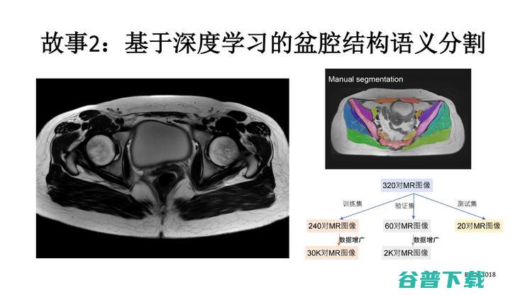 北京和睦家医院放射科陆菁菁：医生在医学影像AI研发中，需要扮演什么样的角色？