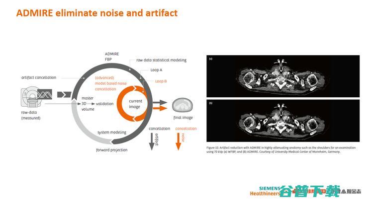西门子医疗 AI 战略全布局丨万字长文