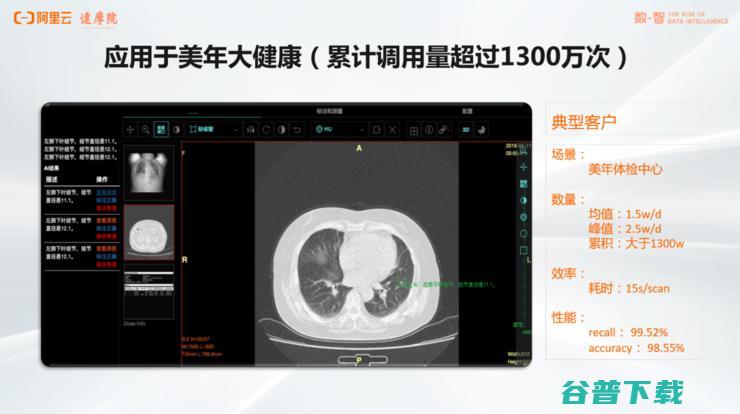 阿里达摩院「医疗AI」的战略全布局丨万字长文