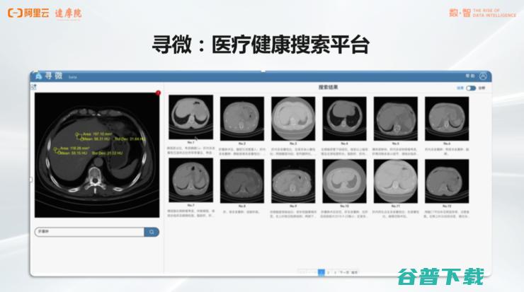 阿里达摩院「医疗AI」的战略全布局丨万字长文