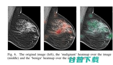 图灵奖得主LeCun用来怼Google的乳腺癌AI论文，有何过人之处？