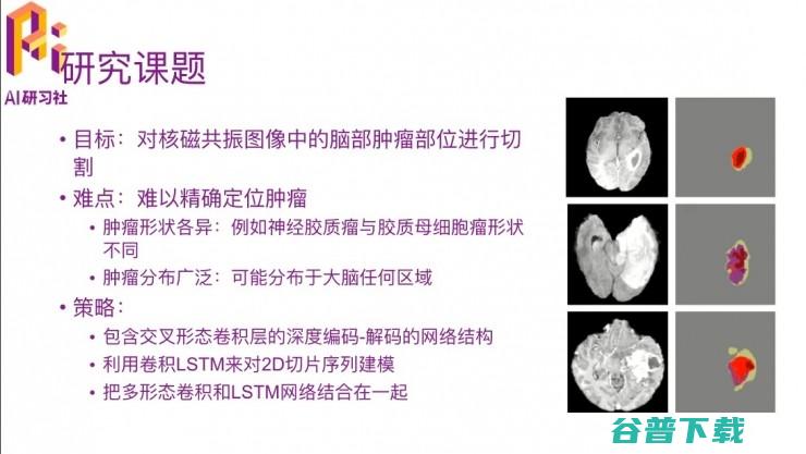 CVPR 2017精彩论文解读：综合使用多形态核磁共振数据的3D生物医学图像分割方法 | 分享总结